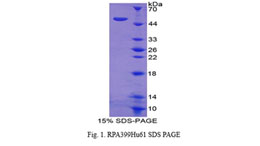 How to Detect HMGB1 (High Mobility Group Box 1) in-vitro