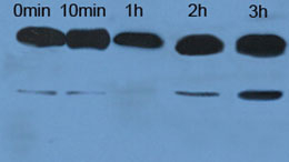 Detection of Active Caspase 3 in Apoptosis 