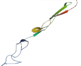 A Disintegrin And Metalloproteinase With Thrombospondin 8 (ADAMTS8)