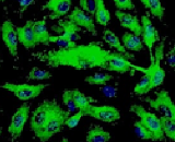 Adipose Microvascular Endothelial Cells (AMEC)