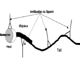 Anti-Sperm Antibody (AsAb)