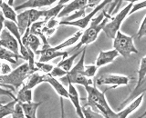 Bladder Stromal Fibroblasts (BSF)