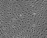 Brain Microvascular Endothelial Cells (BMEC)