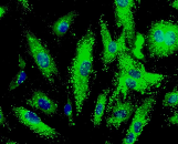 Cardiac Microvascular Endothelial Cells (CMEC)