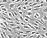 Cervical Microvascular Endothelial Cells (CMEC)