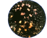 Chlamydia Trachomatis (CT)