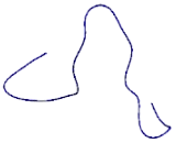 Chromosome 10 Open Reading Frame 35 (C10orf35)