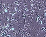 Colon Carcinoma Cells (CCC)