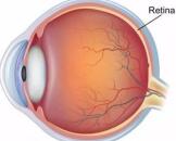 Diabetic Retinopathy (DR)