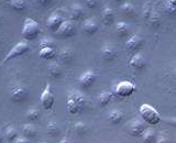 Embryonic Kidney Epithelial Cells (EKC)