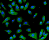 Fetal Epidermal Keratinocytes (FEK)