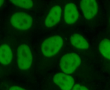 Hepatocellular Carcinoma Cells (HCC)