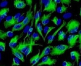 Iris Pigment Epithelial Cells  (IPEC)