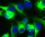 Lens Epithelial Cells (LEC)