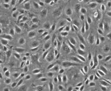 Lymphatic Endothelial Cells (LEC)