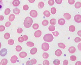 Bone Marrow Mononuclear Cells (BMMC)