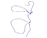 MARCKS Related Protein (MARCKSL1)