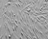 Mammary Fibroblasts (MF)