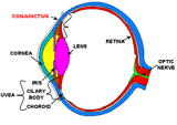 Allergic Conjunctivitis (AC)