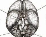 Arterial Thrombosis (BAT)