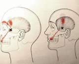 Dental Pain (DP)