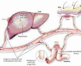 Hemopoietic Microenvironment Injury (HMI)