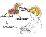 Hyperprolactinemia (HPRL)