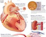 Hypertension (HT)