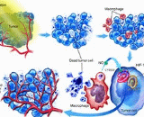 Induced Tumor (IT)