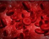 Iron Deficiency Anemia (IDA)