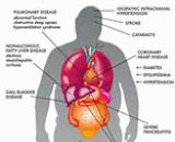 Metabolic Syndrome (MS)