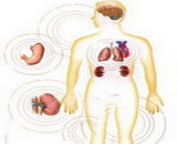 Multiple Organ Dysfunction Syndrome (MODS)