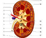 Renovascular Hypertension (RH)