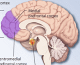 Posttraumatic Stress Disorder (PTSD)