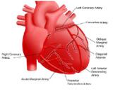 Right Atrium Enlargemnet (RAE)