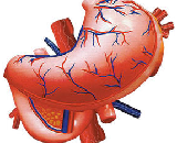 Acute Gastric Ulcer (AGU)