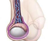 Testicular Fibrosis (TF)