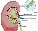 Tubular Injury (TI)