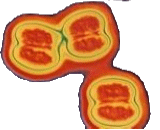 Neisseria Meningitidis (NM)