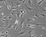 Neonatal Dermal Fibroblasts (NDF)