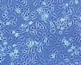 Lung Adenocarcinoma Cells (LA)