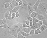 Oral Epidermoid Carcinoma Cells (OECC)