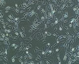 Ovarian Carcinoma Cells (OCC)