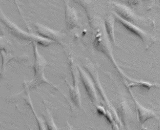 Pericardial Fibroblasts (PF)