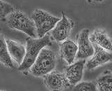 Pituitary Adenoma Cells (PAC)