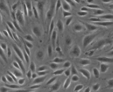 Placental Vascular Endothelial Cells (PVEC)