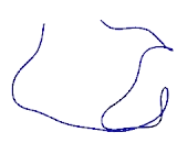 Proline/Histidine/Glycine Rich Protein 1 (PHGR1)