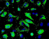 Renal Glomerulus Endothelial Cells (RGEC)