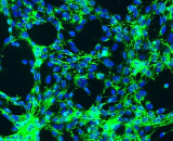 Renal Mesangial Cells (RMC)