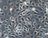 Renal  Tubular Epithelial Cells (RTEC)